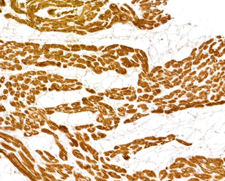 Mouse Cardiac Troponin I Monoclonal Antibody
