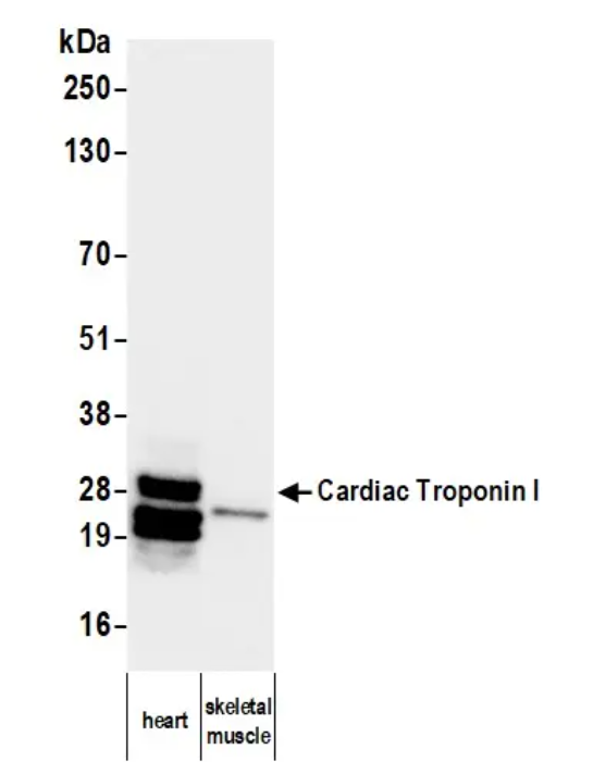 Mouse Cardiac Troponin I Monoclonal Antibody