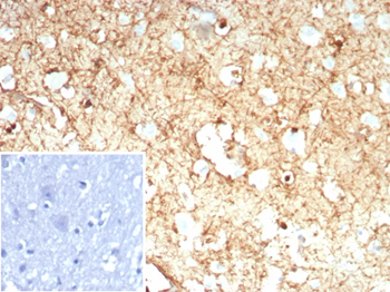 GLUL Antibody