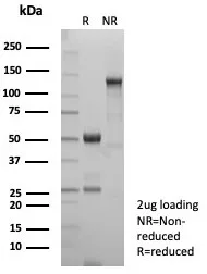 GLUL Antibody