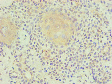 PLA2G7 Antibody