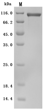Recombinant Human Low affinity immunoglobulin gamma Fc region receptor III-A (FCGR3A), partial (Active)