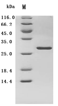Recombinant Human Complement factor D (CFD) (Active)