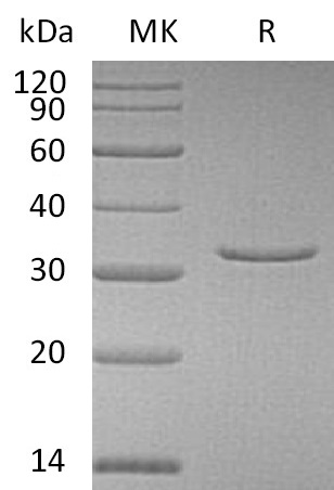 Human VSNL1