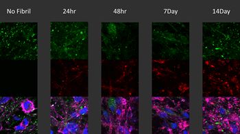 Alpha Synuclein Pre-formed Fibrils: ATTO 594