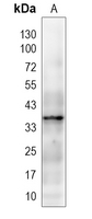 FPR2 Rabbit Polyclonal Antibody