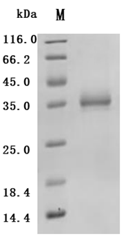 Human SIGLEC15 protein