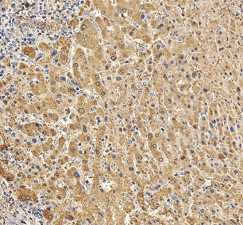 C Reactive Protein/CRP Antibody