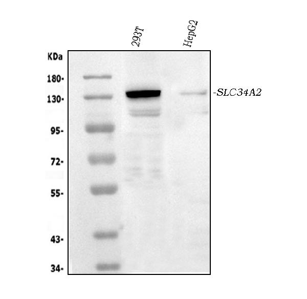 SLC34A2 Rabbit Polyclonal Antibody