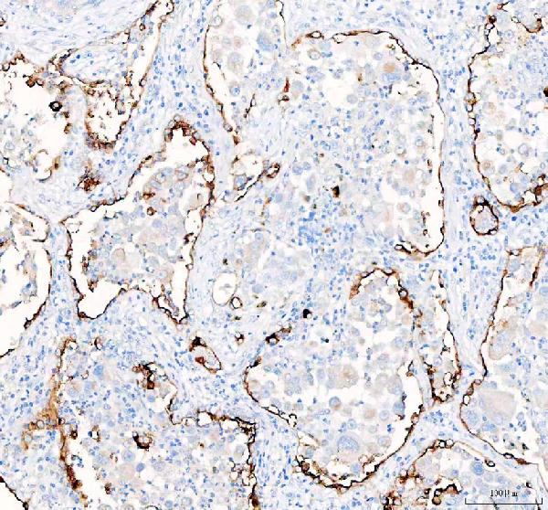 SLC34A2 Rabbit Polyclonal Antibody