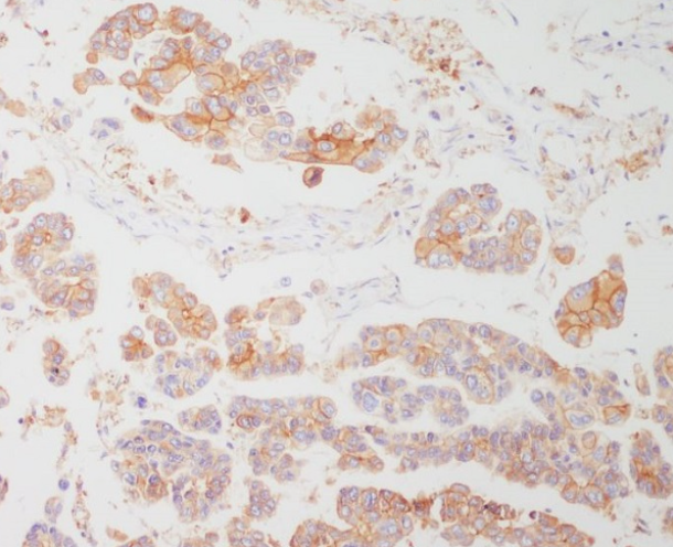 HLA-DRA/Hla Dr/DRA Rabbit Monoclonal Antibody