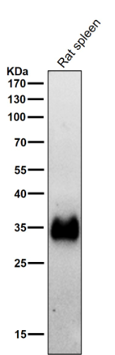 HLA-DRA/Hla Dr/DRA Rabbit Monoclonal Antibody