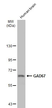 GAD67 Rabbit Polyclonal Antibody