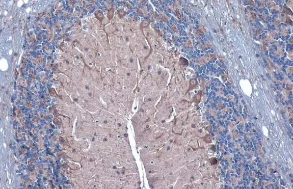 GAD67 Rabbit Polyclonal Antibody