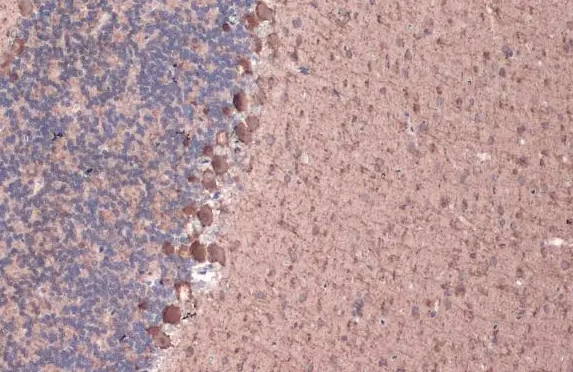 GAD67 Rabbit Polyclonal Antibody