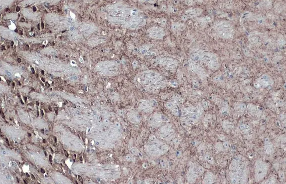 GAD67 Rabbit Polyclonal Antibody