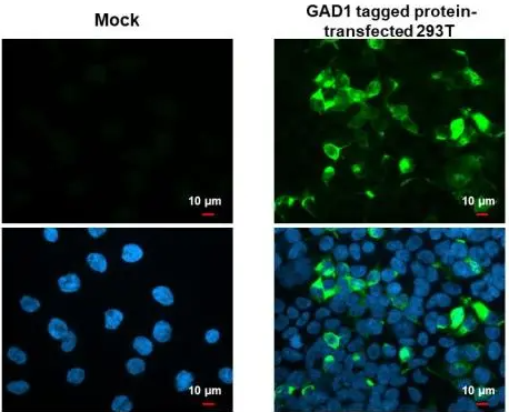 GAD67 Rabbit Polyclonal Antibody