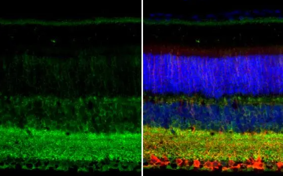 GAD67 Rabbit Polyclonal Antibody