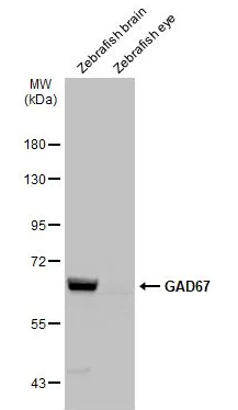 GAD67 Rabbit Polyclonal Antibody