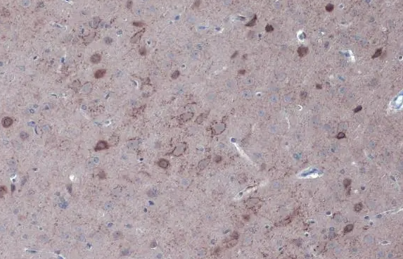 GAD67 Rabbit Polyclonal Antibody