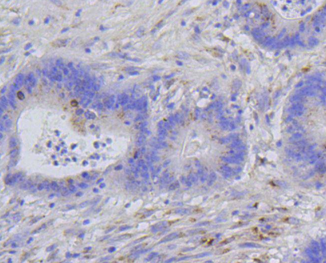 Histone H1.3/Histone H1.4(Phospho-Thr17) Rabbit mAb Antibody
