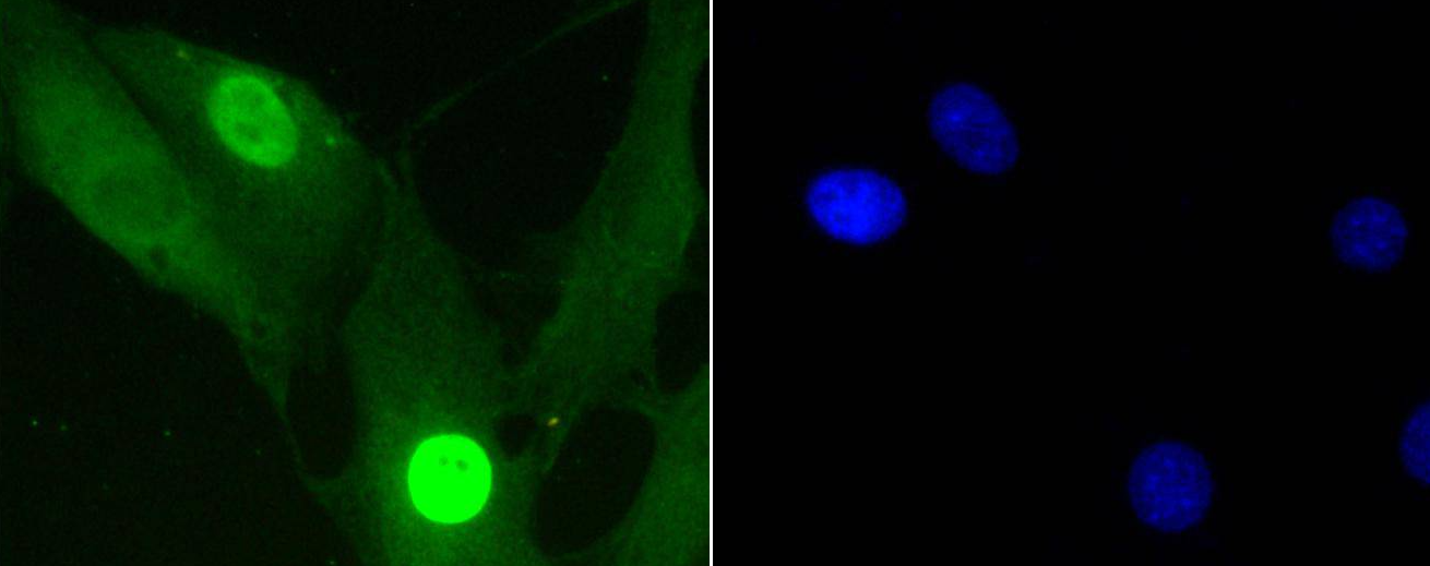 Histone H1.3/Histone H1.4(Phospho-Thr17) Rabbit mAb Antibody