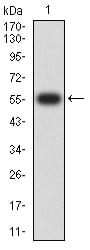 FCGRT Antibody