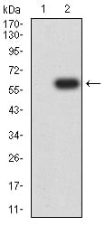 FCGRT Antibody