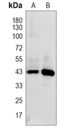 DPEP1 Rabbit Polyclonal Antibody