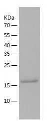 Human SOST Protein, His Tag
