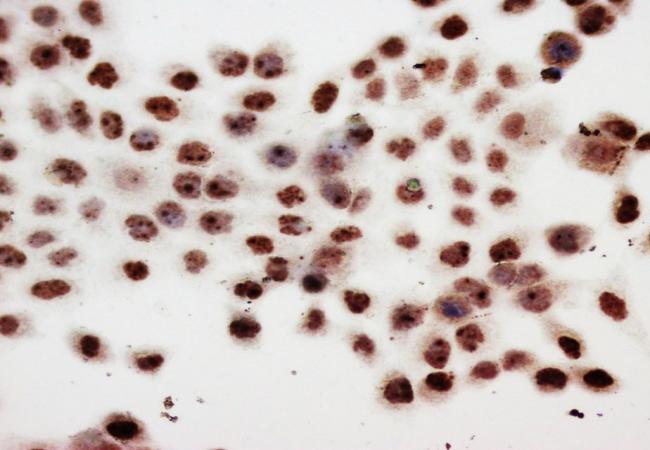 PCNA Mouse Monoclonal Antibody