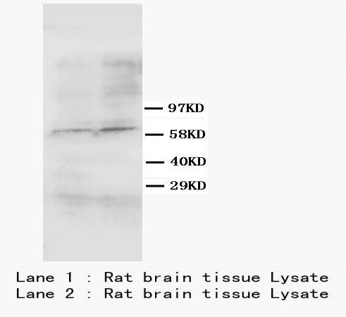 Anti-Smad4(DPC4) Antibody (Monoclonal, DCS-46)