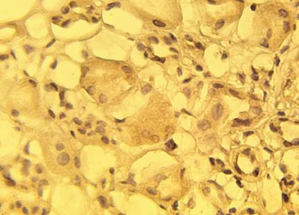 Rabbit anti Human Calcium Channel Antibody