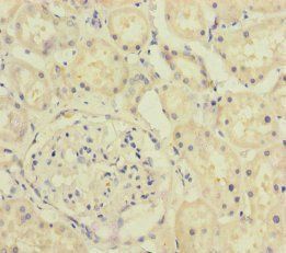 A4GALT Antibody