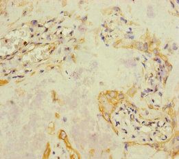 A4GALT Antibody