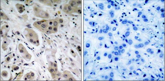 Akt (Phospho-Ser473) Antibody
