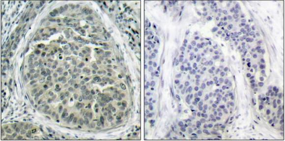 Catenin-β (Phospho-Ser37) Antibody