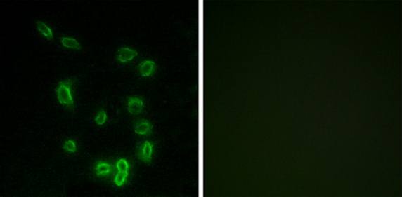 DARPP-32 (Phospho-Thr34) Antibody
