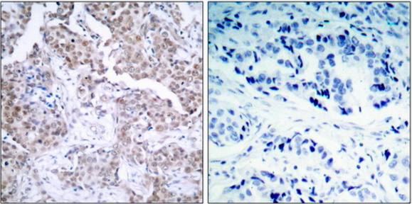 p53 (Phospho-Ser15) Antibody