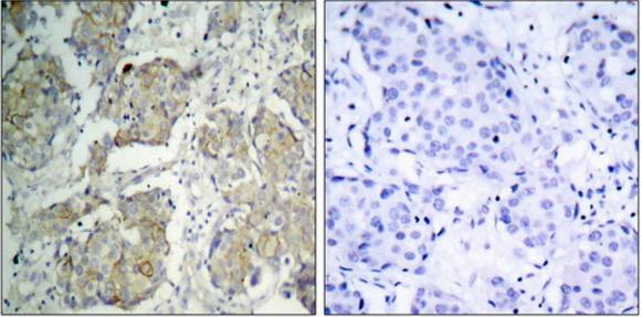 VEGFR2 (Phospho-Tyr1214) Antibody