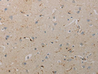 AATK Antibody