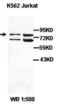 ABCB5 Rabbit Polyclonal Antibody