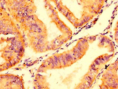 ABCC8 Antibody