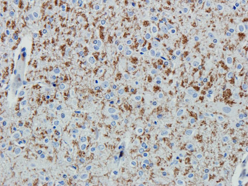 ABCG2 Rabbit Polyclonal Antibody