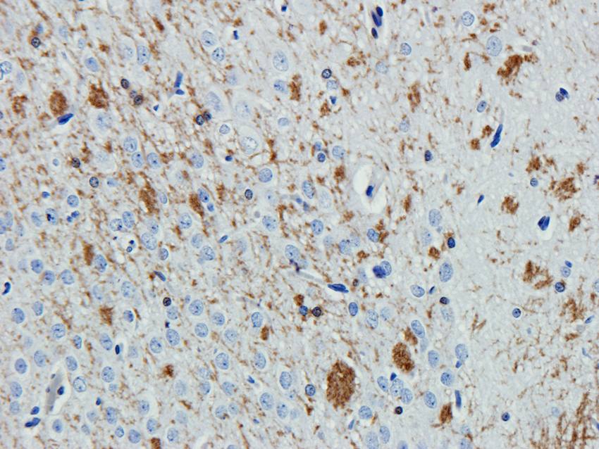 ABCG2 Rabbit Polyclonal Antibody