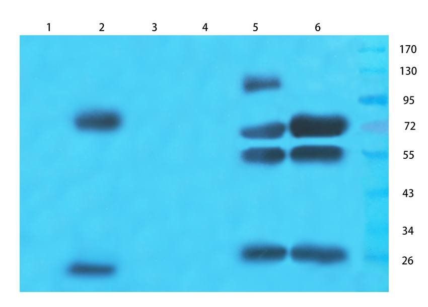 ABCG2 Rabbit Polyclonal Antibody