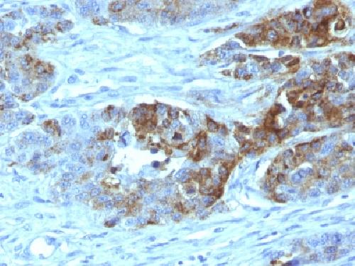 ABO Antibody