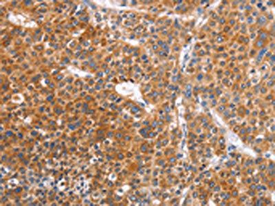 ABO Antibody