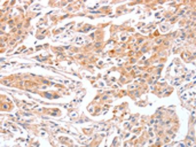 ABO Antibody