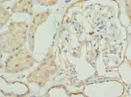 ACADM Antibody